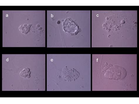 Evolution of experimental blastomere growth observed on feeder cell ...