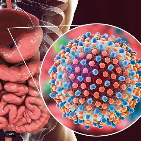 Hepatit C Nedir Nas L Bula R Belirtileri Ve Tedavisi