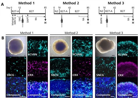 Retinal Organoid Differentiation Methods Determine Organoid Cellular