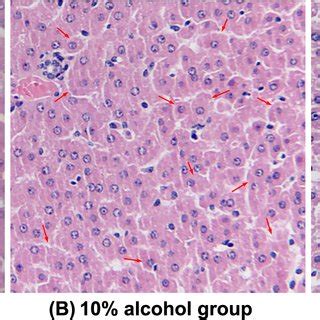 Representative Histological Feature Of Liver Sections Stained With He