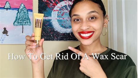 How To Treat A Wax Burn Part2 ANSWERING YOUR QUESTIONS YouTube