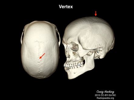 Vertex Anatomy