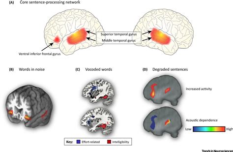 The Neural Consequences Of Age Related Hearing Loss Trends In