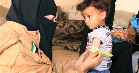 Targeting Malnutrition In Yemen With Treatment And Training