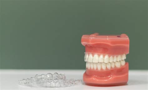 Importance Of Retainers After Invisalign Aligners Treatment