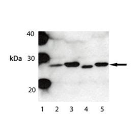 Anti Bak Antibody A01163 IHC IF Validated Bosterbio