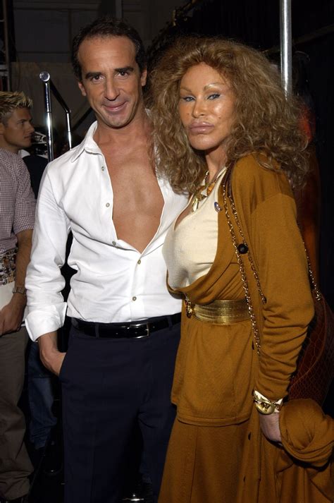 What Really Happened To Jocelyn Wildenstein? The Full, Uncensored Truth Image 7
