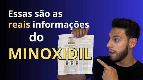 Minoxidil O Que A Bula Realmente Indica Youtube