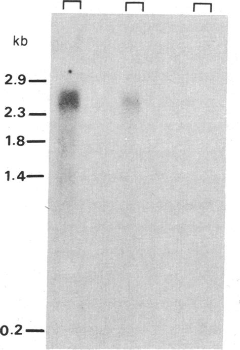 Transfer Blot Hybridization Ofthe Rnas From Liver Testis And Cultured