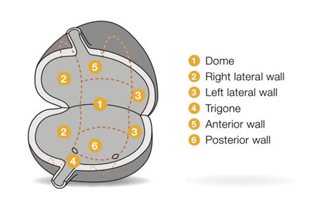 Bladder Dome Anatomy