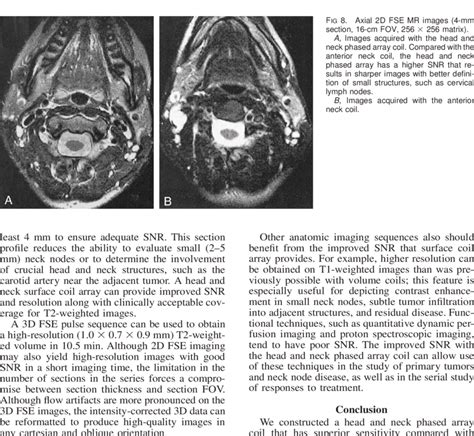 A And B Reformations From Corrected Axial T2 Weighted 3d Fse Mr Data