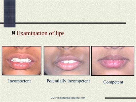 Diagnosis In Orthodontics Certified Fixed Orthodontic Courses By In