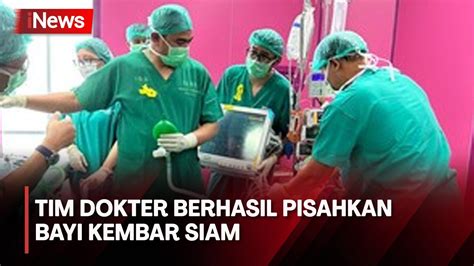 Operasi Bayi Kembar Siam Di Malang Berhasil Dipisahkan Tim Dokter