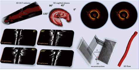 Optimized Automated Segmentation And D Reconstruction Using