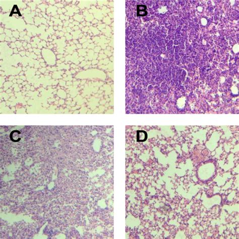 Histopathological Changes In Lung Tissues With He Staining