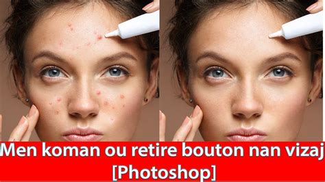 Men Koman Ou Retire Bouton Nan Vizaj Nan Yon Foto Avek Photoshop Youtube