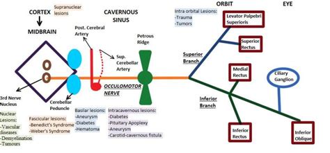 Figure Oculomotor Nerve Contributed By Pranav Modi Mbbs