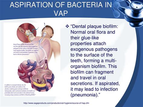 Ppt Ventilator Associated Pneumonia Powerpoint Presentation Free Download Id 2353986