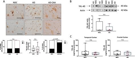 Ykl 40 Immunoreactivity And Protein Levels Remain Similar In Download Scientific Diagram