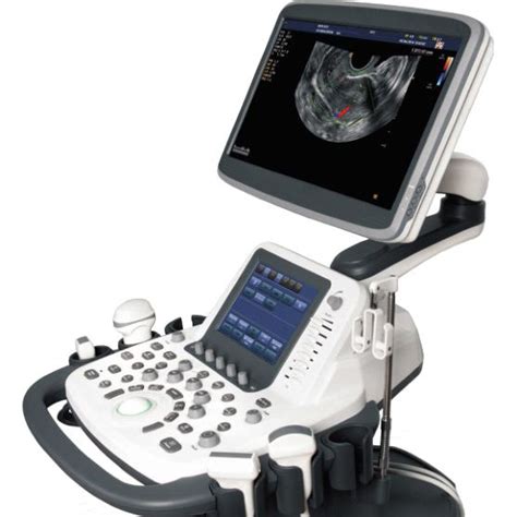 Top Sales Efficient Sonoscape S22 Ultrasound 4d Color Doppler Trolley