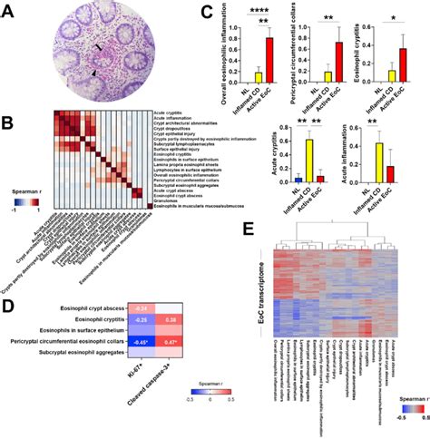 Colonic Histologic Features And Associations With Colonic Transcripts Download Scientific