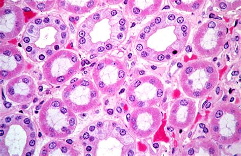 HLS [ Urinary System, kidney, medulla, collecting duct and ascending tubule] HIGH MAG