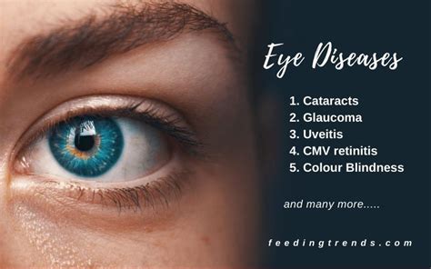 10 Eye Diseases That Are Common These Days | Feeding Trends