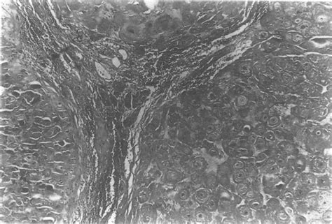 Low Power View Showing Lobules Of Cartilage Separate Concentric Layers