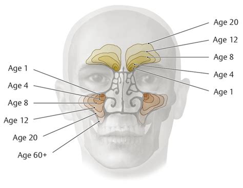 20 Sinuses Radiology Key