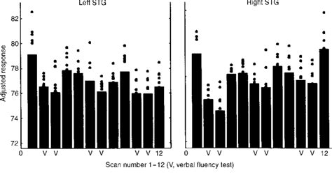 Adjusted Regional Cerebral Blood Flow Rcbf Values In Left And Right