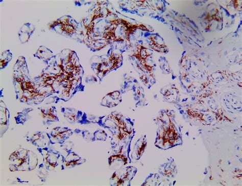 tff antibody bsb  bio sb