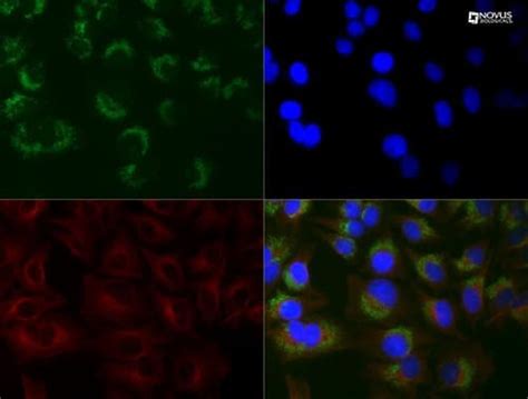 Visualizing Autophagy by Microscopy