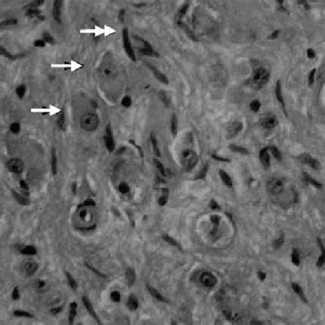 Photomicrograph of ganglion cell-rich area. Arrows point to ganglion ...