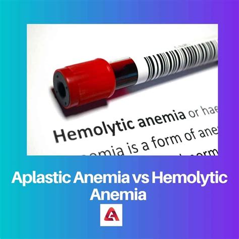 Aplastic Anemia Vs Hemolytic Anemia Difference And Comparison