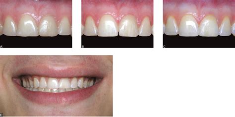 Scielo Brasil 10 Commandments Of Smile Esthetics 10 Commandments Of