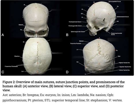 Practicum 2 Axial Skeleton A Sutures Diagram Quizlet