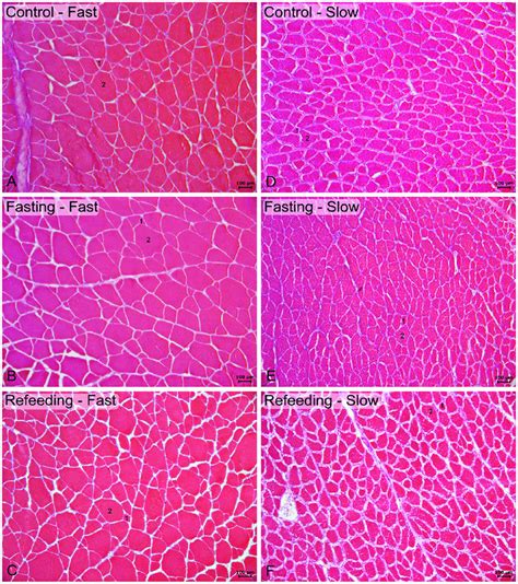 Hematoxylin And Eosin HE Staining Showing Fast Muscle Left Side And