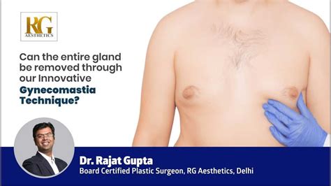 Can The Entire Gland Be Removed Through Our Innovative Gynecomastia Technique Dr Rajat Gupta