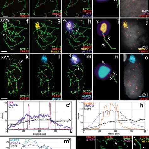 Mid Pachytene Spermatocytes Of Sorex Araneus Double Immunostaining Download Scientific Diagram