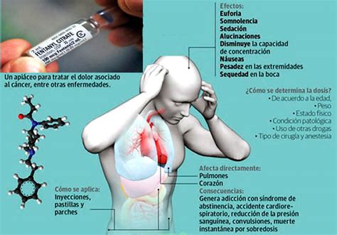 Fentanilo Si Sobrepasas Un Miligramo Puede Ser Mortal Changoonga