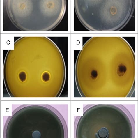 Malassezia Species Colonies Of A High Lipase Activity B Very High