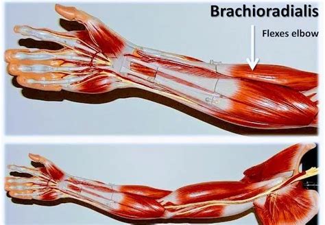 Brachioradialis Muscle Pt Master Guide Muscle Extensor Muscles Radial Nerve