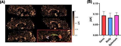 Figure 5 From Frequency Tuned Bipolar Oscillating Gradients For Mapping