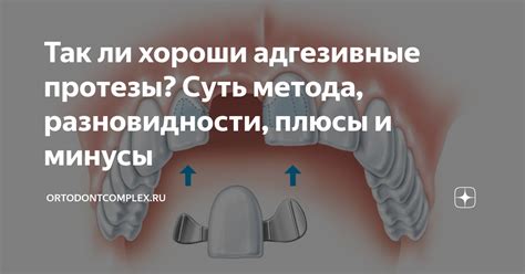 Так ли хороши адгезивные протезы? Суть метода, разновидности, плюсы и ...