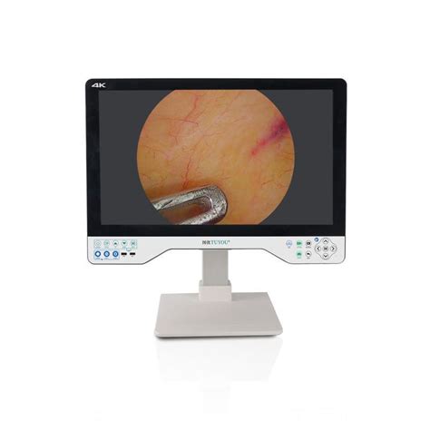 Monitor für Endoskopie TU 24LSD101A Shenzhen Tuyou Medical Imaging