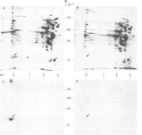 A And B Two Dimensional Gel Electrophoretic Analysis Of Total And Ss