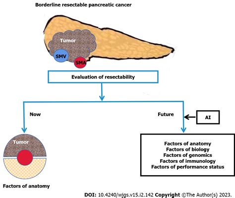 Comprehensive Multimodal Management Of Borderline Resectable Pancreatic