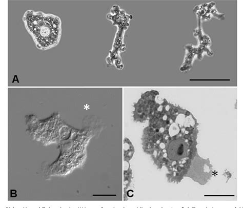 Figure 1 from Balamuthia mandrillaris: Further morphological observations of trophozoites by ...