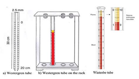erythrocyte sedimentation rate esr significance mechanism