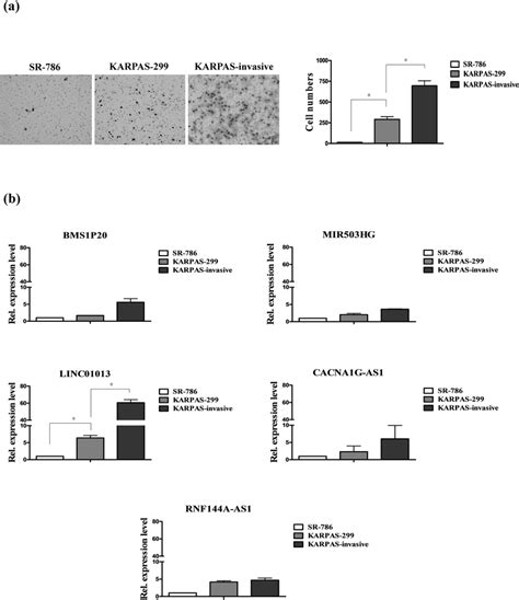 LINC01013 Is Associated With Tumor Invasive Functions A Left Panel